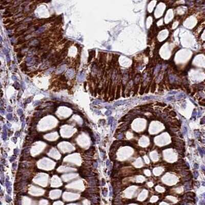 Immunohistochemistry-Paraffin: UQCRFS1 Antibody [NBP1-87826]