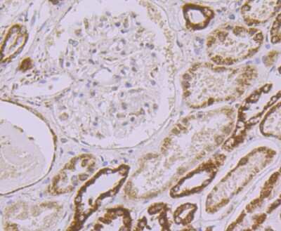 Immunohistochemistry-Paraffin: UQCRFS1 Antibody (JG62-31) [NBP2-75697]