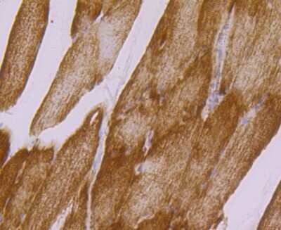 Immunohistochemistry-Paraffin: UQCRFS1 Antibody (JG62-31) [NBP2-75697]
