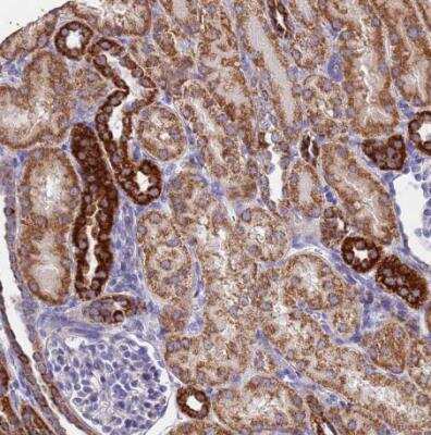 Immunohistochemistry-Paraffin: UQCRH Antibody [NBP1-93442]