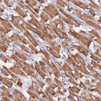 Immunohistochemistry-Paraffin: UQCRQ Antibody [NBP1-92563]