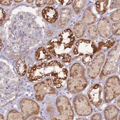 Immunohistochemistry-Paraffin: UQCRQ Antibody [NBP1-92563]