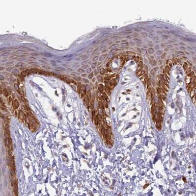 Immunohistochemistry-Paraffin: UQCRQ Antibody [NBP1-92563]