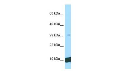 Western Blot: UQCRQ Antibody [NBP2-86043]