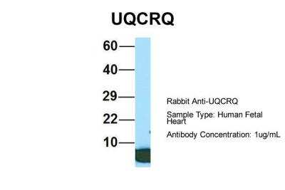 Western Blot: UQCRQ Antibody [NBP2-86043]