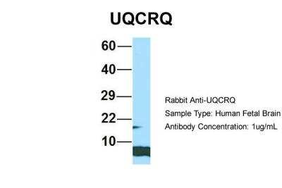 Western Blot: UQCRQ Antibody [NBP2-86043]