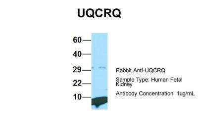 Western Blot: UQCRQ Antibody [NBP2-86043]