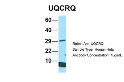 Western Blot: UQCRQ Antibody [NBP2-86043]