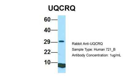 Western Blot: UQCRQ Antibody [NBP2-86043]
