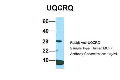 Western Blot: UQCRQ Antibody [NBP2-86043]