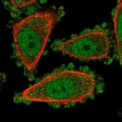 Immunocytochemistry/ Immunofluorescence: UROD Antibody [NBP2-57511]