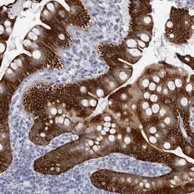 Immunohistochemistry-Paraffin: UROD Antibody [NBP1-85946]