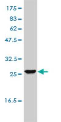 Western Blot: UROS Antibody (1E11-B11) [H00007390-M01]