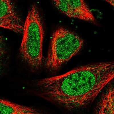 Immunocytochemistry/ Immunofluorescence: UROS Antibody [NBP1-92565]