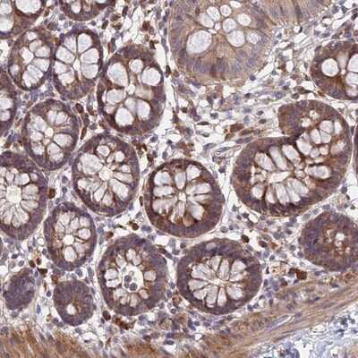 Immunohistochemistry-Paraffin: UROS Antibody [NBP1-92565]
