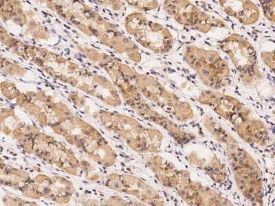 Immunohistochemistry-Paraffin: UROS Antibody [NBP2-97299]