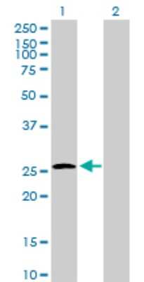 Western Blot: UROS Antibody [H00007390-B01P]