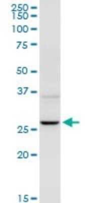 Western Blot: UROS Antibody [H00007390-D01P]