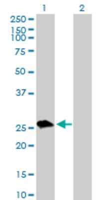Western Blot: UROS Antibody [H00007390-D01P]