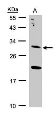 Western Blot: UROS Antibody [NBP1-32485]