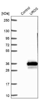Western Blot: UROS Antibody [NBP1-92565]