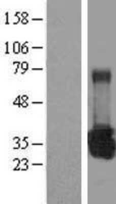 Western Blot: UROS Overexpression Lysate [NBL1-17635]