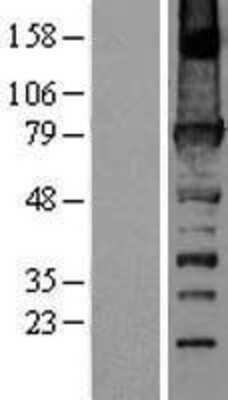 Western Blot: FERMT3/URP2 Overexpression Lysate [NBL1-10678]