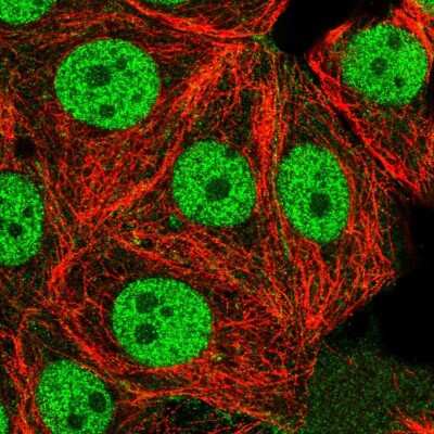 Immunocytochemistry/ Immunofluorescence: USF1 Antibody [NBP2-55392]