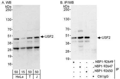 Immunoprecipitation: USF2 Antibody [NBP1-92647]