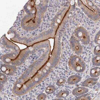 Immunohistochemistry-Paraffin: USH1C Antibody [NBP1-89191]