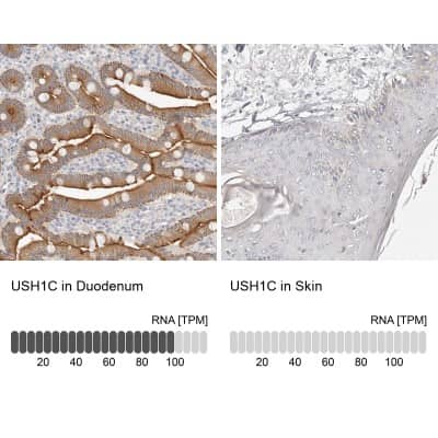 Immunohistochemistry-Paraffin: USH1C Antibody [NBP1-89189]