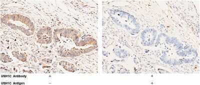 Immunohistochemistry-Paraffin: USH1C Antibody [NBP2-99408]