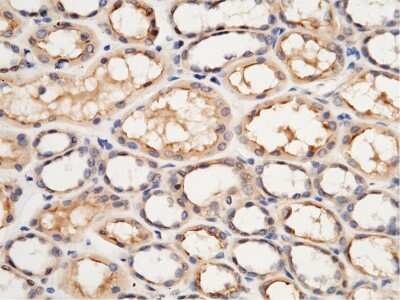 Immunohistochemistry-Paraffin: USH1C Antibody [NBP2-99408]