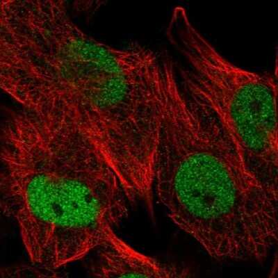 Immunocytochemistry/ Immunofluorescence: USP1 Antibody [NBP2-55036]