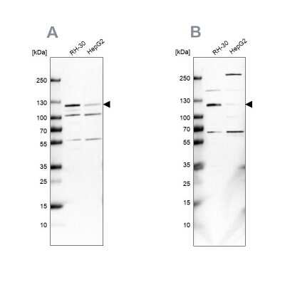 Western Blot: USP1 Antibody [NBP1-85950]