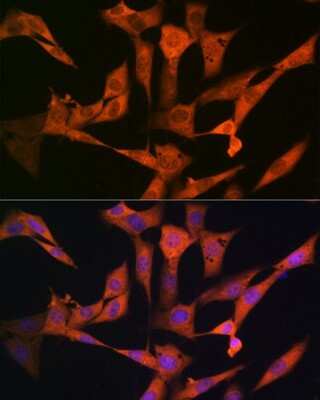 Immunocytochemistry/ Immunofluorescence: USP10 Antibody (9L6F3) [NBP3-16416]