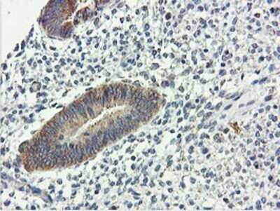 Immunohistochemistry: USP10 Antibody (OTI2E1) - Azide and BSA Free [NBP2-74798]