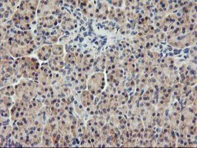 Immunohistochemistry: USP10 Antibody (OTI2E1) - Azide and BSA Free [NBP2-74798]
