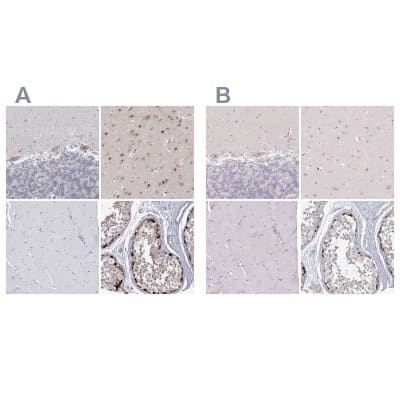 Immunohistochemistry-Paraffin: USP11 Antibody [NBP1-80639]