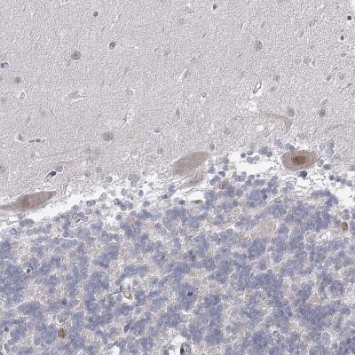 Immunohistochemistry-Paraffin: USP11 Antibody [NBP1-80639]