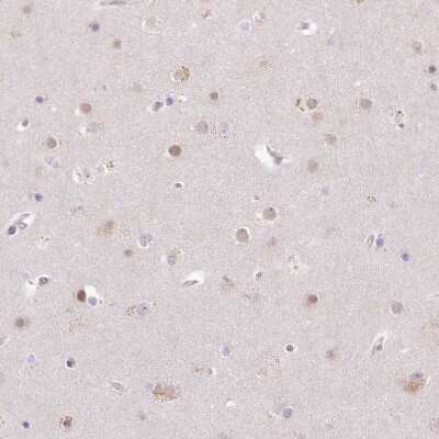 Immunohistochemistry-Paraffin: USP11 Antibody [NBP1-80640]