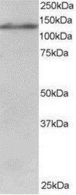 Western Blot: USP11 Antibody [NB100-1251]