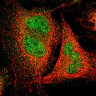 Immunocytochemistry/ Immunofluorescence: USP13 Antibody [NBP1-83088]