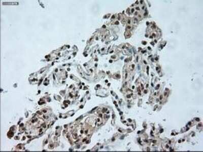 Immunohistochemistry: USP13 Antibody (OTI4G11) - Azide and BSA Free [NBP2-74802]