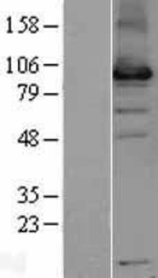 Western Blot: USP13 Overexpression Lysate [NBL1-17645]