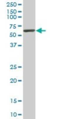 Western Blot: USP14 Antibody (1F8) [H00009097-M08]