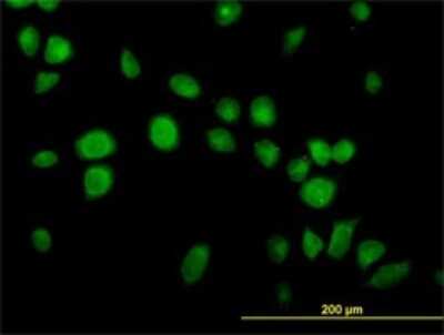 Immunocytochemistry/ Immunofluorescence: USP14 Antibody (6D6) [H00009097-M04]