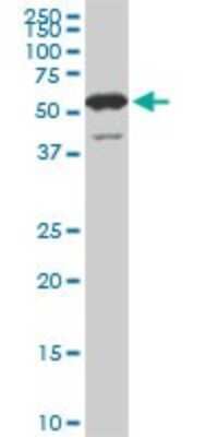 Western Blot: USP14 Antibody (6D6) [H00009097-M04]