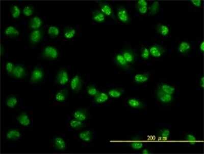 Immunocytochemistry/ Immunofluorescence: USP15 Antibody (1C10) [H00009958-M01]