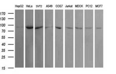 Western Blot: USP16 Antibody (OTI1B4) [NBP2-46305]